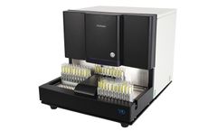 URiSCAN - Model PluScope - High-end FullyAutomated Urine Sediment Analyzer