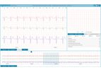 GETEMED - Version HeartX Viewer - Web-based ECG Viewer for Telemedical ECG Reporting