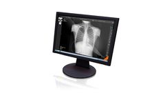 GEMSS - Version Xview4 - Smart Software