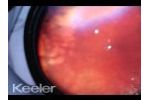 Rop Laser and Periphery Mini Clip - Video