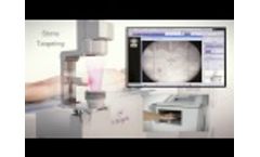 Integra Electromagnetic SWL System by DirexGroup Brochure