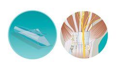 VIVOSORB - Polymer Film