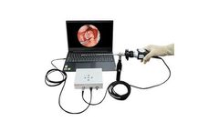 SHREK - Model SY-HD7021 - Portable HD Endoscope USB Camera