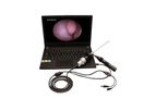 SHREK - Portable Endoscope USB Camera