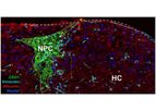 ExVive - 3D Bioprinted Human Liver Tissue
