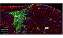 ExVive - 3D Bioprinted Human Liver Tissue