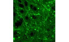 Cerevast - Transcranial Ultrasound Neuromodulation