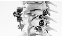 K.M. BABY - Adult Cervical Arthrodesis & Paediatric Spinal Deformities