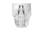 J.O.C. - Rod-Plates for Occipito-Cervical Arthrodesis