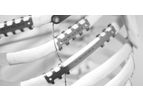 ThoRib - Thoracic Osteosynthesis System