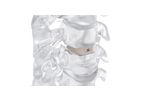 Neuro - Model Pm Cage - Anterior Cervical Interbody Fusion Cage