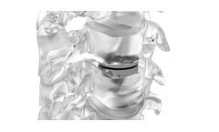Neuro - Model Dynalis-C - Cervical Disk Prosthesis
