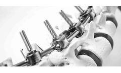Neuro - Model S.E.S + - Thoraco-Lumbar Fixation System Particularly Adapted To Scoliosis.
