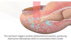 Lunula Laser Animation - Video