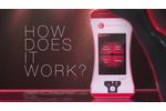 Erchonia Low Level Laser Overview (How it works) - Video