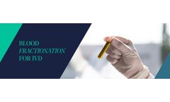 SEQENS - Blood Fractionation for IVD