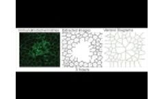 r:GEN - RPE Regeneration Process - Video