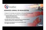 Visualize: Vascular | Overview - Video
