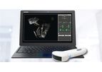 Pathway - Ultrasound Imaging System for Lumbopelvic Rehabilitation