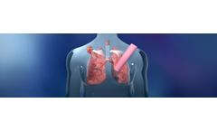 Biostage - Cellspan Tracheal Implants