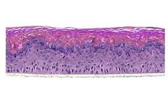 SkinEthic - Model RHE - Human Epidermis