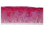 SkinEthic - Model RHE-LC - Human Epidermal Model Langerhans Cells