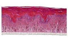 SkinEthic - Model RHE-LC - Human Epidermal Model Langerhans Cells