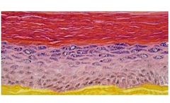 EpiSkin - Small or Large Human Epidermis