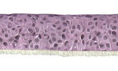 SkinEthic - Model HOE - Human Oral Epithelium