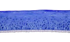 SkinEthic - Model HGE - Human Gingival Epithelium