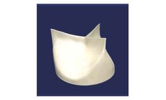 DurAVR - 3D Single-piece Aortic Heart Valve