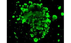 3D bioprinting technology for liver disease