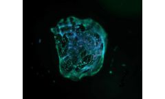 3D bioprinting technology for skin disease