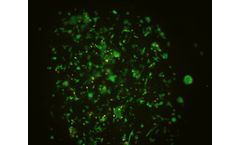3D bioprinting technology for pancreas disease