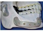 Bionacre - Bone Replacement Technology
