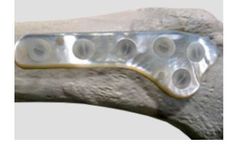 Mega-Biopharma - Trauma Plates