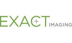 EDAP Announces Exclusive Worldwide Distribution Rights to Exact Imaging’s Micro-Ultrasound Technologies