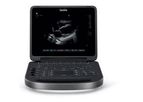 Sonosite Edge - Model II - Ultrasound Machine