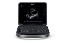 Sonosite Edge - Model II - Ultrasound Machine