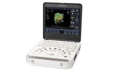 Philips - Model CX50 - Ultrasound Machine