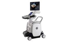 GE VIVID - Model E9 - Ultrasound Machine