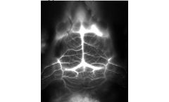 Nirmidas - Model NIR-II -NIR-I-II - Near Infra-Red Dye Technology