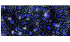 CyteSeer - Automated Video Analysis Software