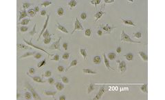 Vala - Model Cat. CXPR-25 - hiPSC-Derived Microglia Cell