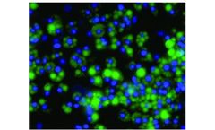 Vala - Model Cat. 4856 - Anti-P-Perilipin 1-Serine 522 Antibody Reagent