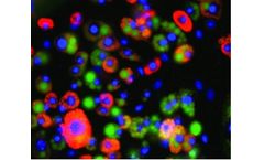 Vala - Model Cat. 4856 - Anti-P-Perilipin 1-Serine 522 Antibody Reagent