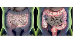 OptiBiotix - Human Microbiome Technology
