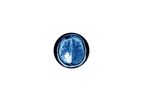Glioblastoma Multiforme (GBM)
