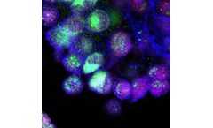 DiscGenics - Therapy Discogenic Cell