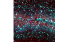 Neurona - Chronic Disorders of the Nervous System
